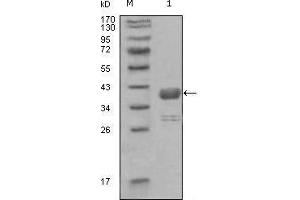 Western blot analysis using ABL1 mouse mAb against truncated GST-ABL1 recombinant protein (1). (ABL1 anticorps  (AA 577-650))