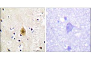Immunohistochemical staining of paraffin-embedded human brain tissue reacted with STK4/STK3 (phospho T183) polyclonal antibody  at 1:50-1:100 dilution. (STK4 anticorps  (pThr183))