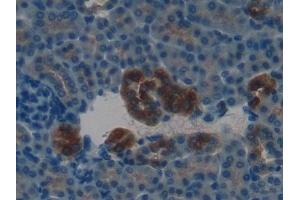 Detection of KLK4 in Mouse Kidney Tissue using Polyclonal Antibody to Kallikrein 4 (KLK4)