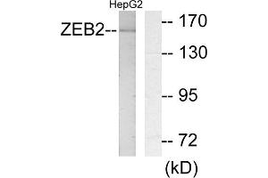 Western blot analysis of extracts from HepG2 cells, using ZEB2 antibody. (ZEB2 anticorps  (N-Term))