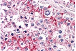 Human Testis: Formalin-Fixed, Paraffin-Embedded (FFPE) (TLN1 anticorps  (AA 1052-1150))