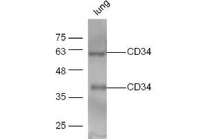 Mouse lung lysate probed with Anti-CD34 Polyclonal Antibody, Unconjugated  at 1:5000 for 90 min at 37˚C.
