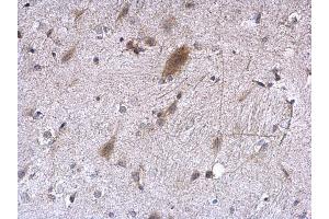 IHC-P Image EEF1E1 antibody [N1C3] detects EEF1E1 protein at cytoplasm on mouse fore brain by immunohistochemical analysis. (EEF1E1 anticorps)