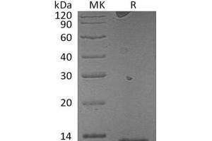 Western Blotting (WB) image for S100 Calcium Binding Protein A7A (S100A7A) protein (ABIN7320634) (S100A7A Protéine)