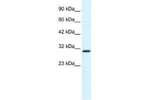 WB Suggested Anti-FLJ20729 Antibody Titration:  1. (FLJ20729 (C-Term) anticorps)
