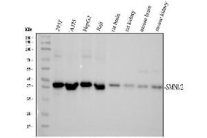 Western blot analysis of SMN1/2 using anti-SMN1/2 antibody (ABIN5693315).