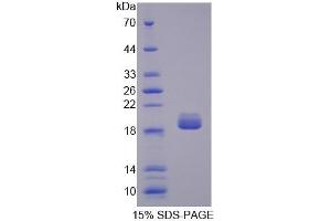 SDS-PAGE of Protein Standard from the Kit (Highly purified E.