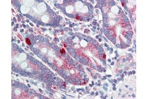 MED4 antibody was used for immunohistochemistry at a concentration of 4-8 ug/ml.