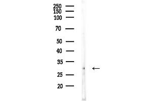 anti-Carcinoembryonic Antigen-Related Cell Adhesion Molecule 3 (CEACAM3) (Internal Region) antibody