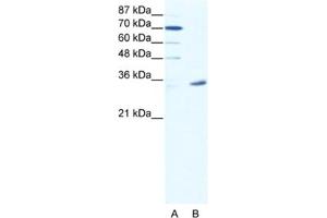 Western Blotting (WB) image for anti-Melanoma Antigen Family A, 9 (MAGEA9) antibody (ABIN2461754) (MAGEA9 anticorps)