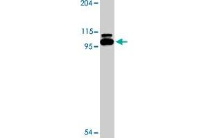 Western blot analysis of TLR6 expression in Jurkat cell lysate with TLR6 polyclonal antibody  at 2 ug/mL . (TLR6 anticorps  (Internal Region))