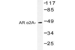 Western blot (WB) analysis of AR alpha2A antibody in extracts from Jurkat cells. (ADRA2A anticorps)