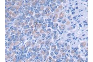 DAB staining on IHC-P; Samples: Mouse Stomach Tissue