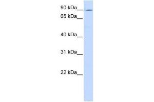 ATP2C1 antibody used at 1 ug/ml to detect target protein. (ATP2C1 anticorps  (C-Term))