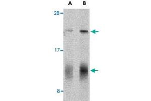 Western blot analysis of IL32 in human spleen tissue lysate with IL32 polyclonal antibody  at (A) 5 and (B) 10 ug/mL shows two isoforms of IL-32.