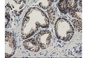 Image no. 3 for anti-Sepiapterin Reductase (SPR) antibody (ABIN1501111)