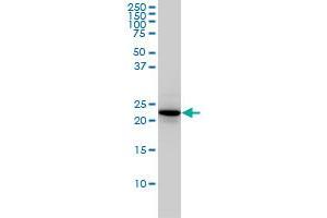 RAB4A monoclonal antibody (M01), clone 1C10 Western Blot analysis of RAB4A expression in Hela . (Rab4 anticorps  (AA 1-218))