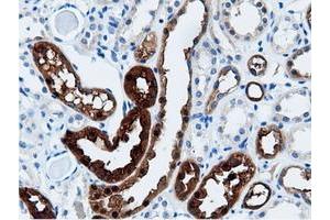 Image no. 5 for anti-Adenylate Kinase 5 (AK5) antibody (ABIN1496535) (Adenylate Kinase 5 anticorps)