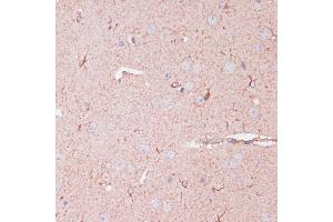 Immunohistochemistry of paraffin-embedded mouse brain using CD82 antibody (ABIN6131855, ABIN6138233, ABIN6138234 and ABIN6218884) at dilution of 1:100 (40x lens). (CD82 anticorps  (C-Term))