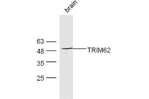 Mouse brain lysates probed with Rabbit Anti-TRIM62 Polyclonal Antibody, Unconjugated  at 1:300 overnight at 4˚C. (TRIM62 anticorps  (AA 101-200))