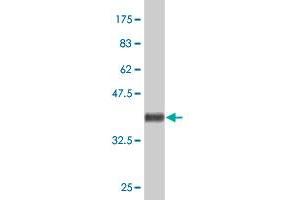 Western Blot detection against Immunogen (38.