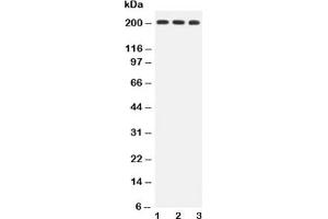 Western blot testing of BRCA1 antibody and Lane 1:  HeLa;  2: MCF-7;  3: A549 lysate