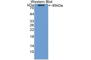 Western blot analysis of the recombinant protein. (Vitamin D-Binding Protein anticorps  (AA 17-476))