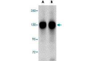 Western blot analysis of FAM120A in SK-N-SH cell lysate with FAM120A polyclonal antibody  at (A) 0. (FAM120A anticorps  (Internal Region))