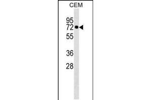Western blot analysis in CEM cell line lysates (35ug/lane). (KLHL28 anticorps  (C-Term))