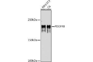 Western blot analysis of extracts of various cell lines, using PDGFRB antibody (ABIN6134579, ABIN6145372 and ABIN7101437) at 1:1000 dilution. (PDGFRB anticorps)