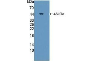 Detection of Recombinant STAM2, Mouse using Polyclonal Antibody to Signal Transducing Adaptor Molecule 2 (STAM2) (STAM2 anticorps  (AA 1-377))