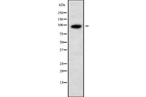 Western blot analysis UNC5A using Jurkat whole cell lysates (UNC5A anticorps  (Internal Region))