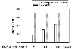 A431 cells were stimulated by different concentrations of EGF for 10 min at 37 (EGFR Kit ELISA)