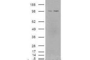 Western blot analysis of LXR in lysates of cells that were transfected with the pCMV6-ENTRY control or pCMV6-ENTRY NR1H3 cDNA using NR1H3/NR1H2 polyclonal antibody . (NR1H3 anticorps  (AA 50-150))
