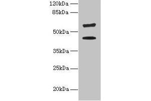 Western blot All lanes: KRT73 antibody at 4 μg/mL + HepG2 whole cell lysate Secondary Goat polyclonal to rabbit IgG at 1/10000 dilution Predicted band size: 59, 42 kDa Observed band size: 59, 42 kDa (KRT73 anticorps  (AA 1-300))