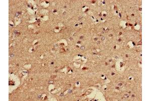 Immunohistochemistry of paraffin-embedded human brain tissue using ABIN7147705 at dilution of 1:100