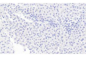 ABIN334436 Negative Control showing staining of paraffin embedded Human Liver, with no primary antibody. (MGLL anticorps  (Internal Region))