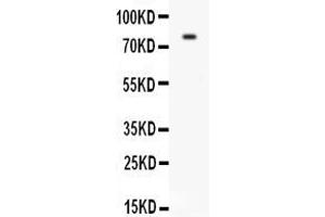 Anti-CD31 antibody, ,Western blottingAll lanes: Anti CD31  at 0. (CD31 anticorps  (C-Term))