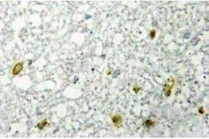 Immunohistochemistry (IHC) analyzes of FoxE1 antibody in paraffin-embedded human RAW264. (FOXE1 anticorps)