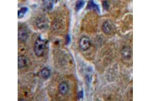 Used in DAB staining on fromalin fixed paraffin-embedded Liver tissue