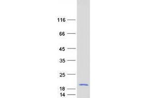 Validation with Western Blot