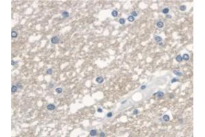 anti-3-Oxoacid CoA Transferase 1 (OXCT1) (AA 40-489) antibody