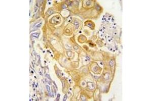 Image no. 2 for anti-Prostaglandin I2 (Prostacyclin) Synthase (PTGIS) (N-Term) antibody (ABIN360419)