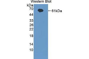 Western blot analysis of the recombinant protein. (IL20RA anticorps  (AA 269-545))