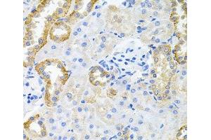 Immunohistochemistry of paraffin-embedded Rat kidney using STRN3 Polyclonal Antibody at dilution of 1:100 (40x lens).