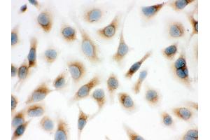 IHC analysis of Surfactant protein D using anti-Surfactant protein D antibody .
