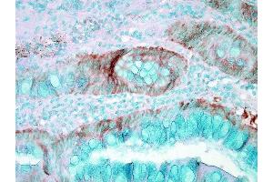 Immunohistochemistry analysis using Rabbit Anti-HSP70 Polyclonal Antibody (ABIN361820 and ABIN361821). (HSP70 anticorps)