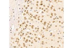 Immunohistochemistry of paraffin embedded mouse brain using neun (ABIN7075479) at dilution of 1: 500 (300x lens) (NeuN anticorps)