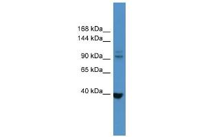 WB Suggested Anti-LTK Antibody Titration: 0.