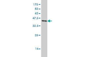 Western Blot detection against Immunogen (37.